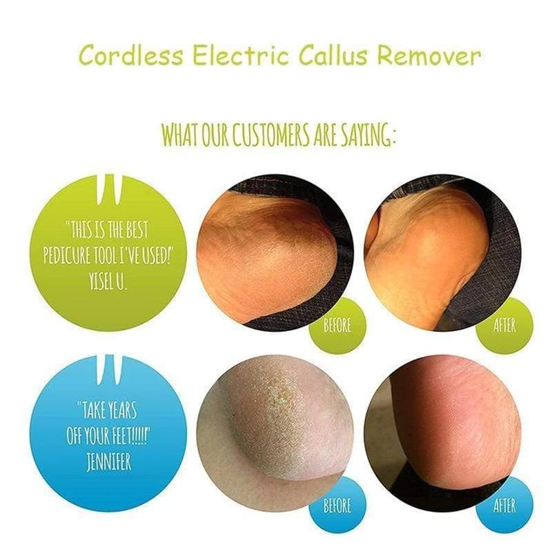 Cordless Electric Callus Remover